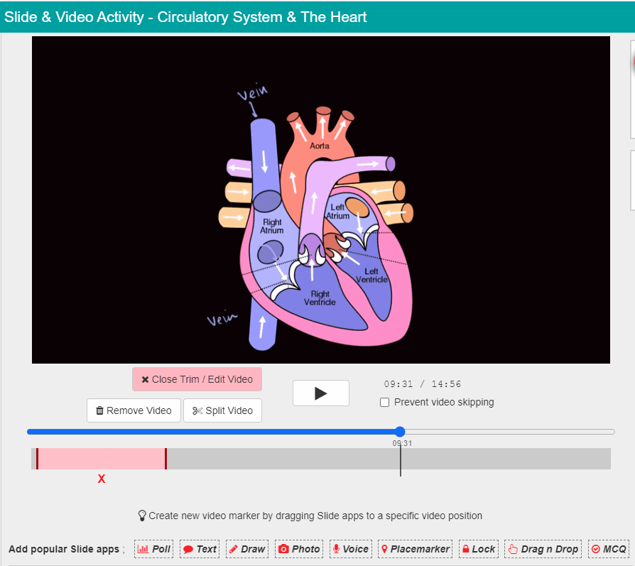 Video Activity showing a heart diagram and playback timeline.